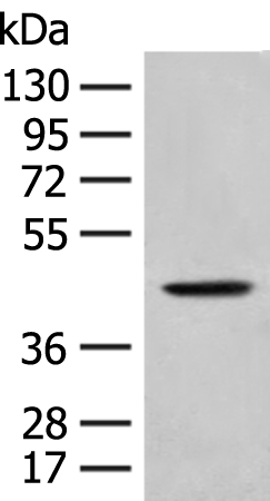 Rabbit Polyclonal Antibody to HLA-B