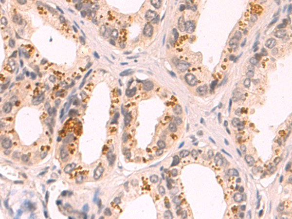 Rabbit Polyclonal Antibody to HLA-C