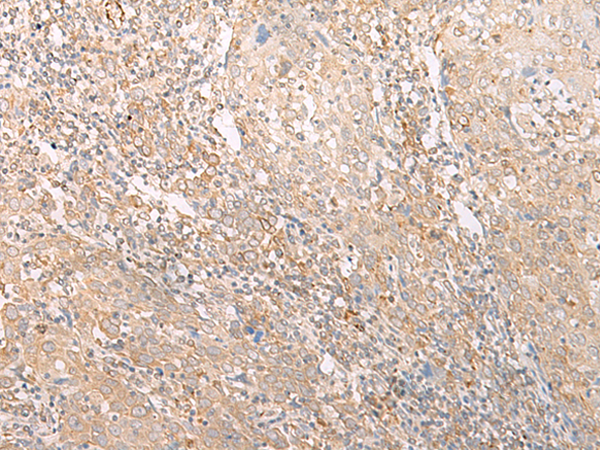 Rabbit Polyclonal Antibody to EPS15