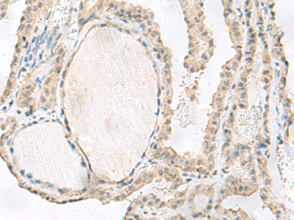 Rabbit Polyclonal Antibody to EPN2