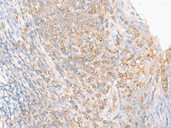 Rabbit Polyclonal Antibody to ERAP2