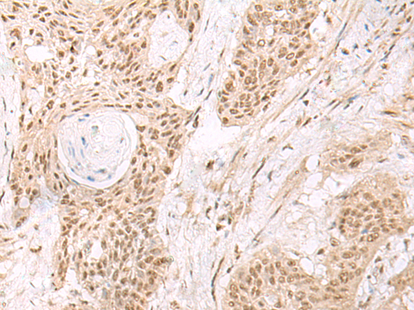 Rabbit Polyclonal Antibody to ESPN