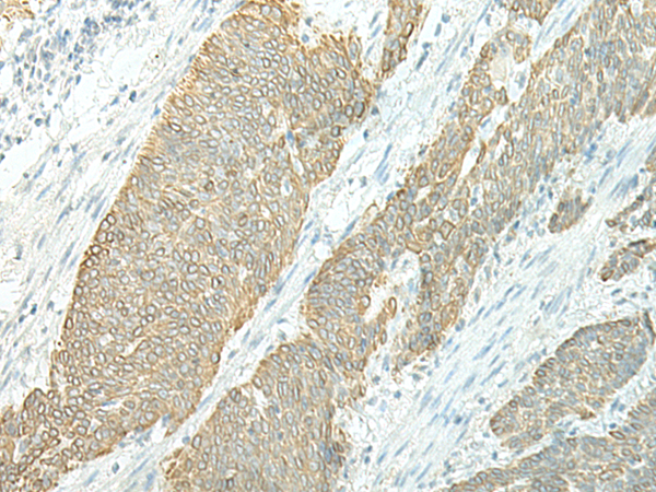 Rabbit Polyclonal Antibody to ETAA1
