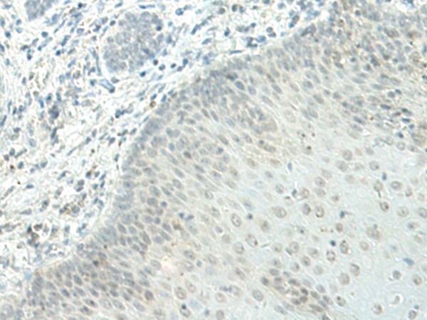 Rabbit Polyclonal Antibody to ETV2