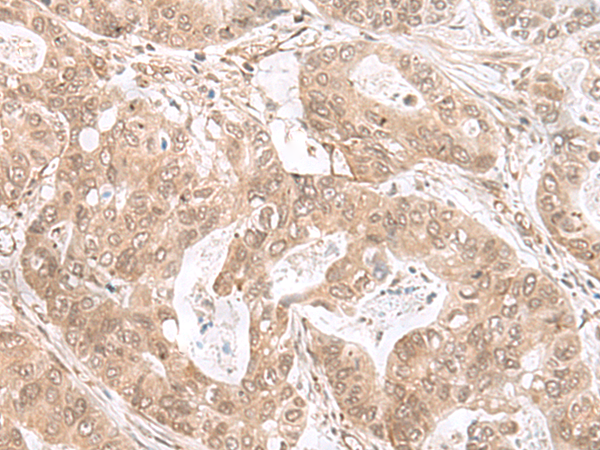 Rabbit Polyclonal Antibody to ETV3