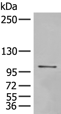 Rabbit Polyclonal Antibody to MECOM