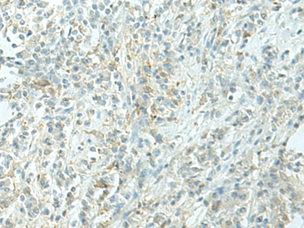 Rabbit Polyclonal Antibody to EVI2B