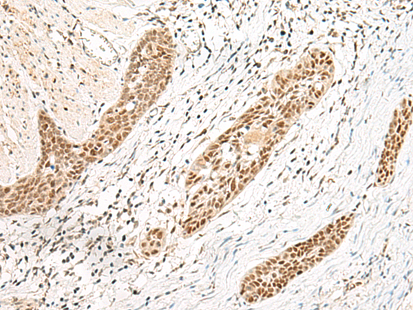 Rabbit Polyclonal Antibody to EVX1