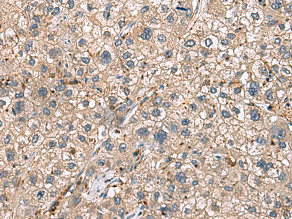 Rabbit Polyclonal Antibody to HLA-DRA