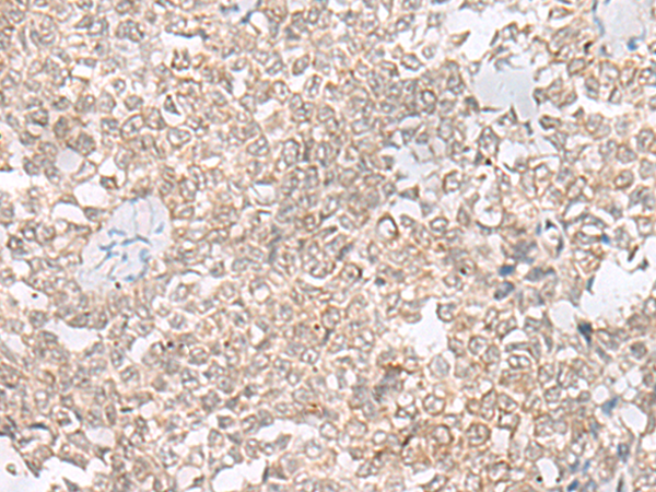 Rabbit Polyclonal Antibody to EHMT2