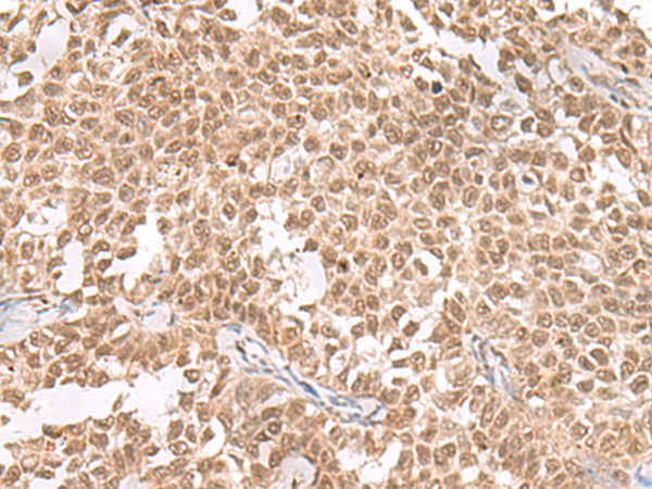 Rabbit Polyclonal Antibody to ZNF560