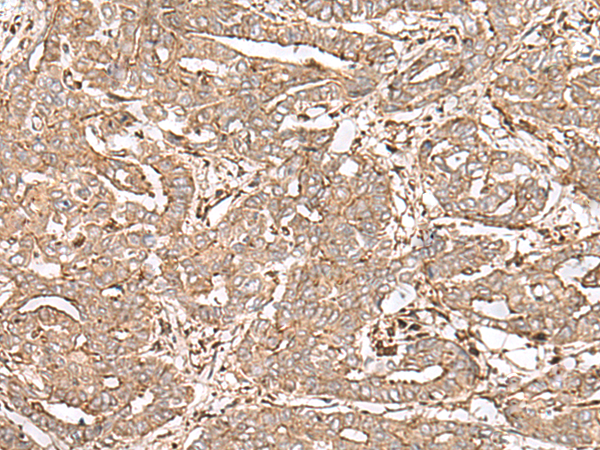 Rabbit Polyclonal Antibody to FAAP24