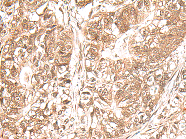 Rabbit Polyclonal Antibody to USP16
