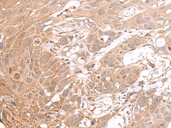 Rabbit Polyclonal Antibody to CHST4
