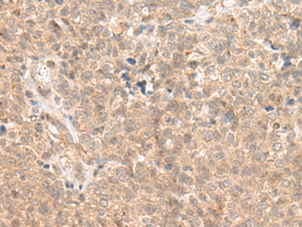 Rabbit Polyclonal Antibody to UTP4