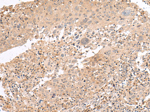 Rabbit Polyclonal Antibody to PATJ