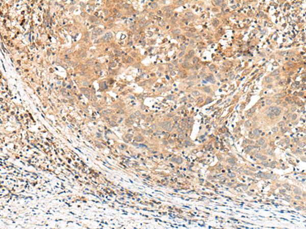 Rabbit Polyclonal Antibody to KCNA10