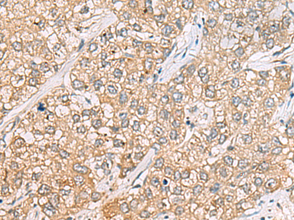 Rabbit Polyclonal Antibody to P3H2
