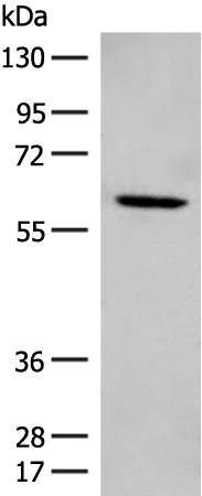 Rabbit Polyclonal Antibody to ME2