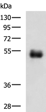 Rabbit Polyclonal Antibody to METTL17