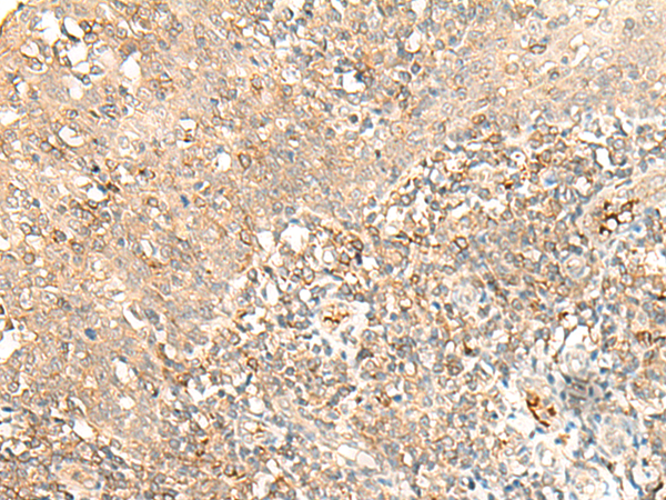 Rabbit Polyclonal Antibody to MOB3B