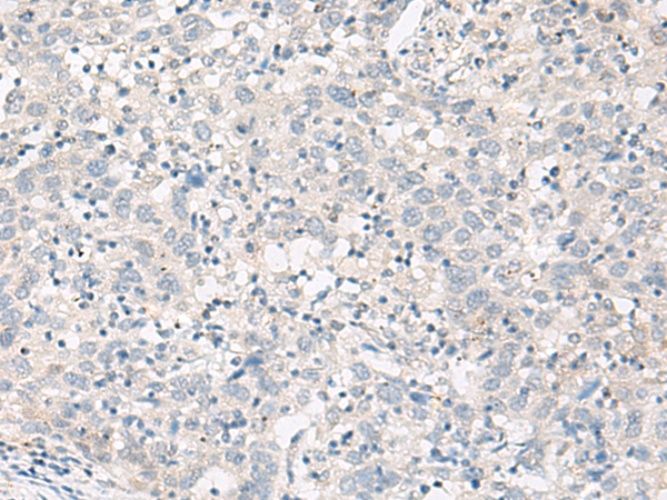 Rabbit Polyclonal Antibody to F5(Coagulation factor V heavy chain)