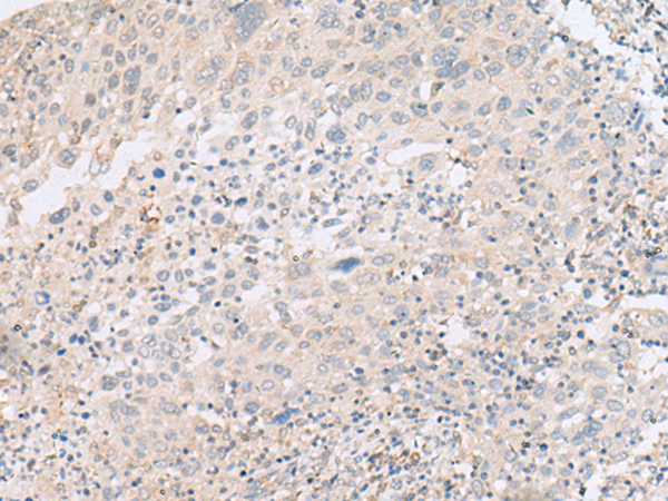 Rabbit Polyclonal Antibody to ABHD17B