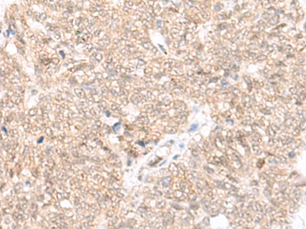 Rabbit Polyclonal Antibody to FAM111B