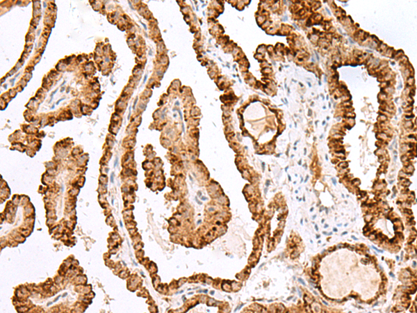Rabbit Polyclonal Antibody to SAXO2