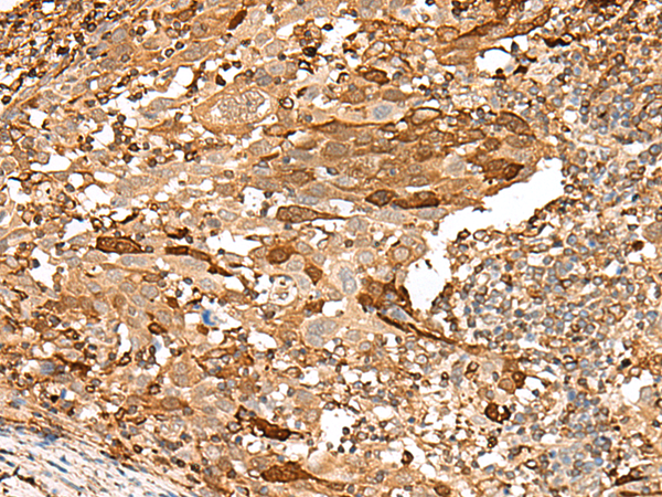 Rabbit Polyclonal Antibody to PIEZO2