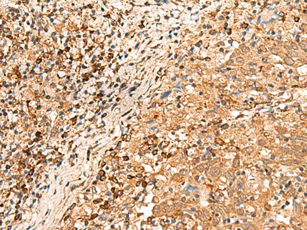 Rabbit Polyclonal Antibody to LRATD1