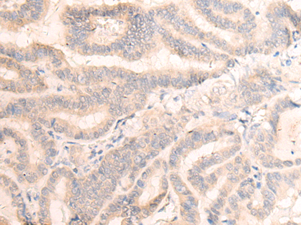 Rabbit Polyclonal Antibody to FAM91A1