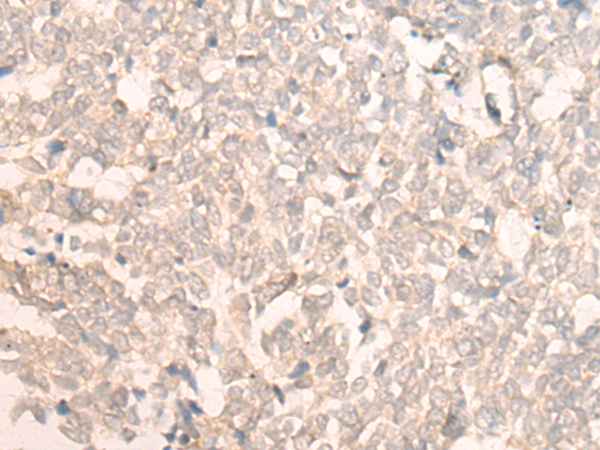 Rabbit Polyclonal Antibody to FAN1