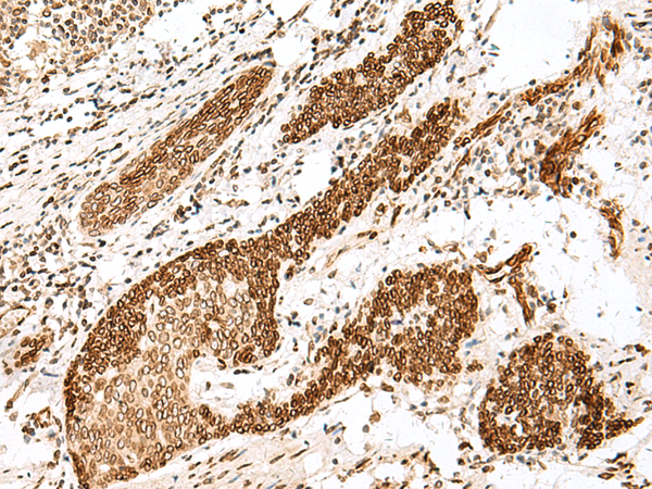 Rabbit Polyclonal Antibody to FANCB