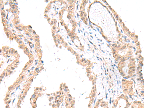 Rabbit Polyclonal Antibody to FANCE
