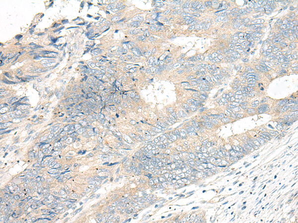 Rabbit Polyclonal Antibody to FBXO9