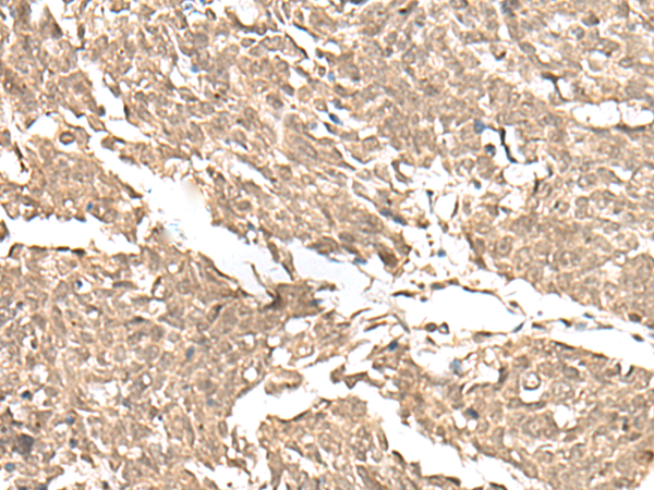 Rabbit Polyclonal Antibody to KDM2A