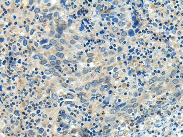 Rabbit Polyclonal Antibody to FBXL16