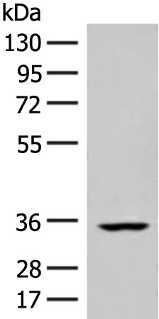 Rabbit Polyclonal Antibody to FBXO16