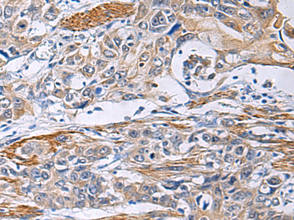 Rabbit Polyclonal Antibody to FBXO45