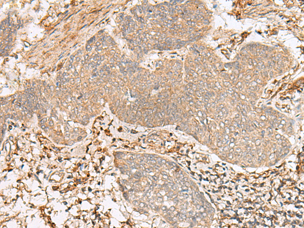 Rabbit Polyclonal Antibody to FBXW8