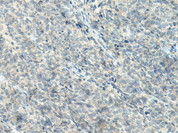 Rabbit Polyclonal Antibody to NPVF