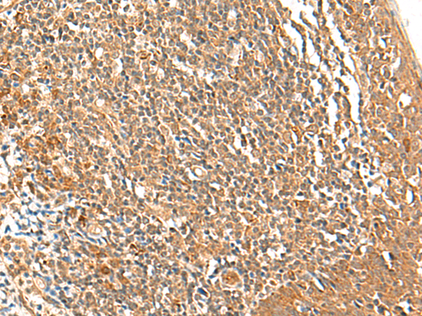 Rabbit Polyclonal Antibody to TSHB