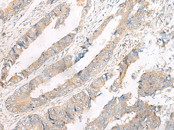 Rabbit Polyclonal Antibody to FERD3L