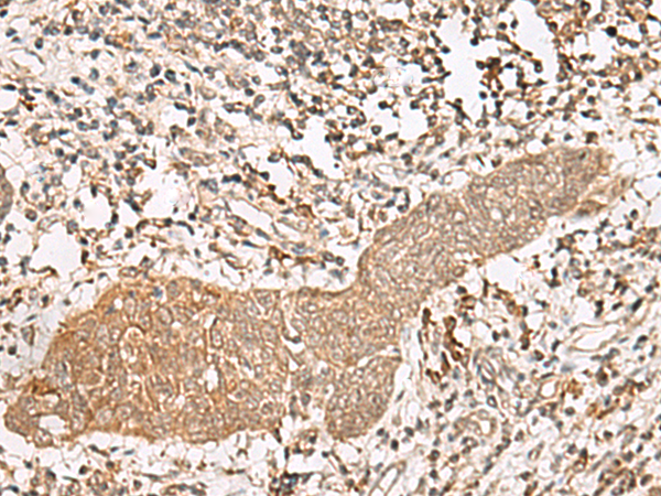 Rabbit Polyclonal Antibody to FGF13