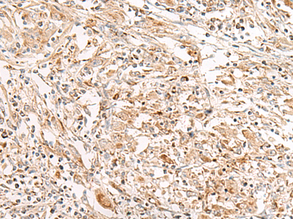 Rabbit Polyclonal Antibody to FGR