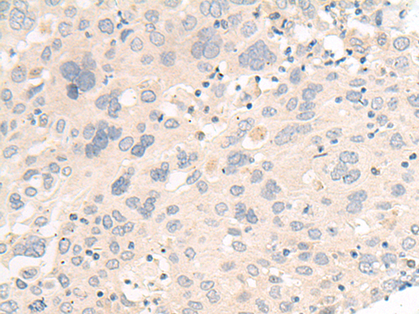 Rabbit Polyclonal Antibody to FHOD1