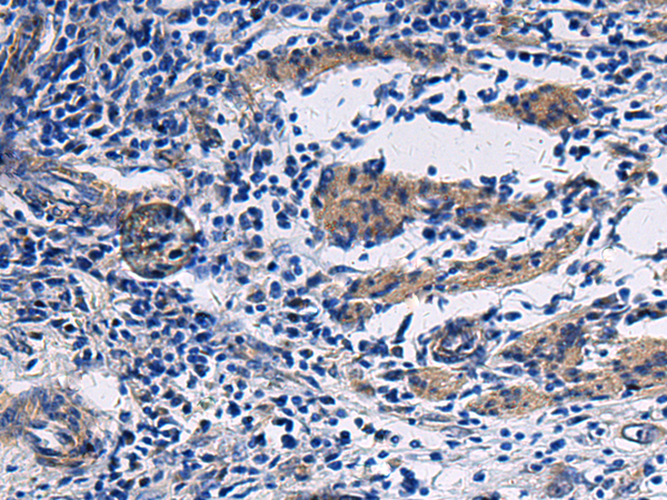 Rabbit Polyclonal Antibody to NAA60