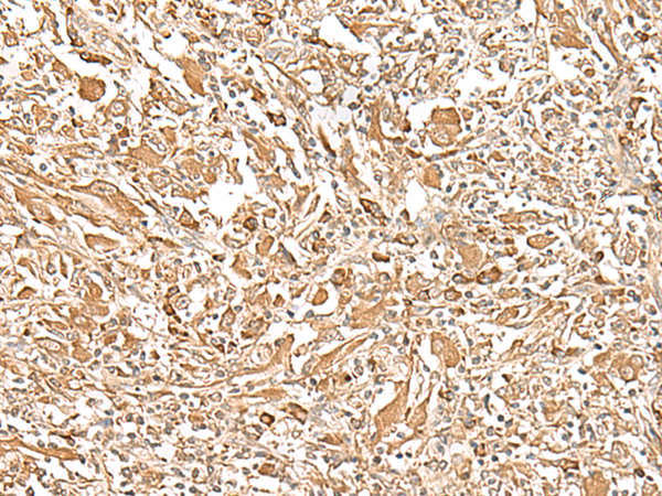 Rabbit Polyclonal Antibody to PLBD1