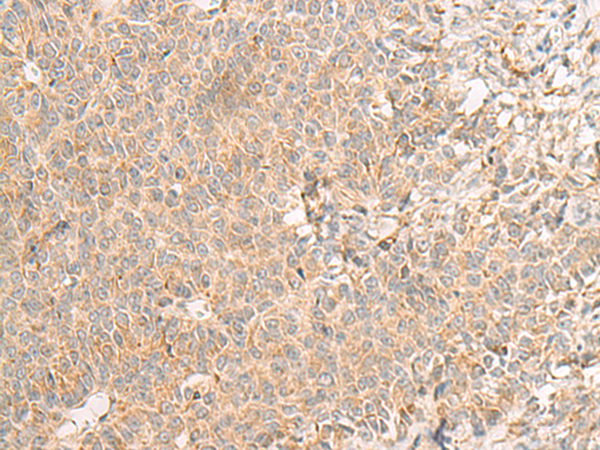 Rabbit Polyclonal Antibody to RNF207